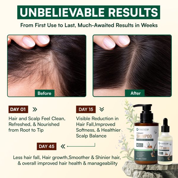 Rosemary-anti-hair fall-and-hair-growth-sulfate-free-shampoo-and-serum